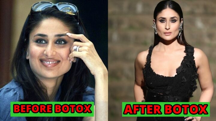 These are the BOTOX BEAUTIES of BOLLYWOOD!