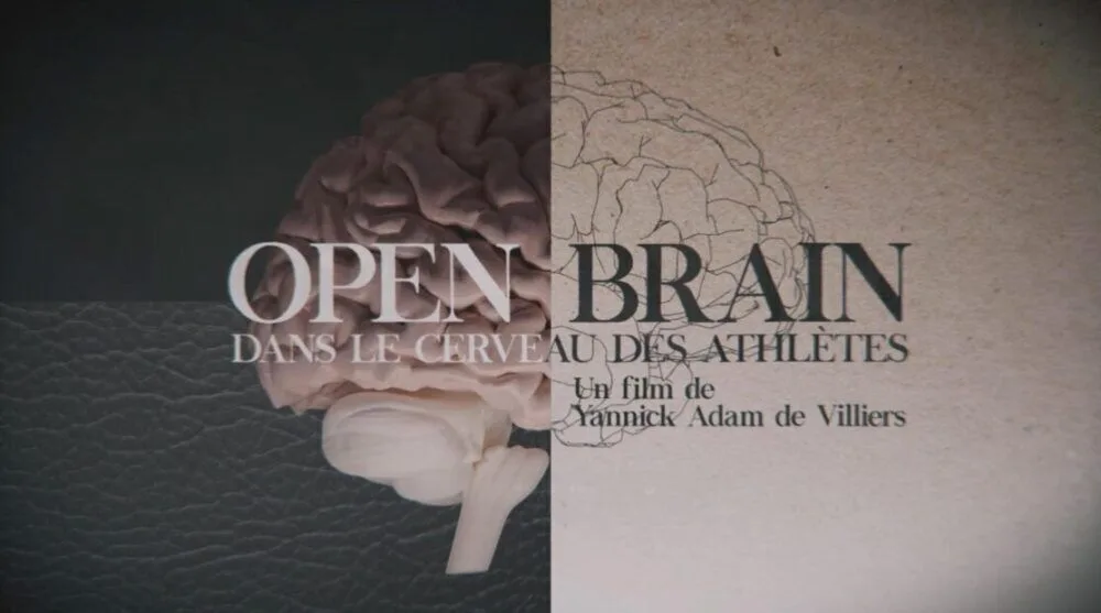 Open Brain 2025 Movie Cast, OTT, Budget, Box Office, And More