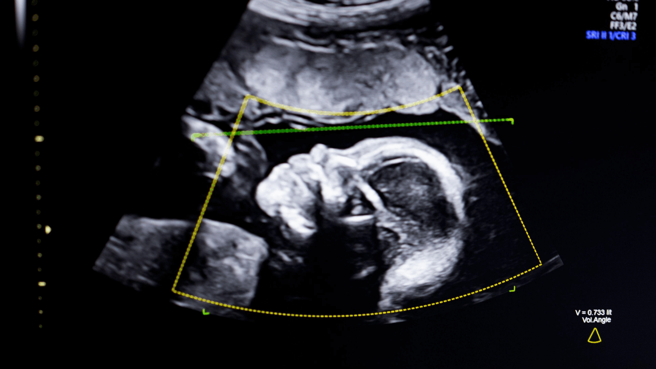 Crisis on the High Street: 'Entertainment' Baby Scans Put Lives at Risk, Triggering Urgent Call for New Law
